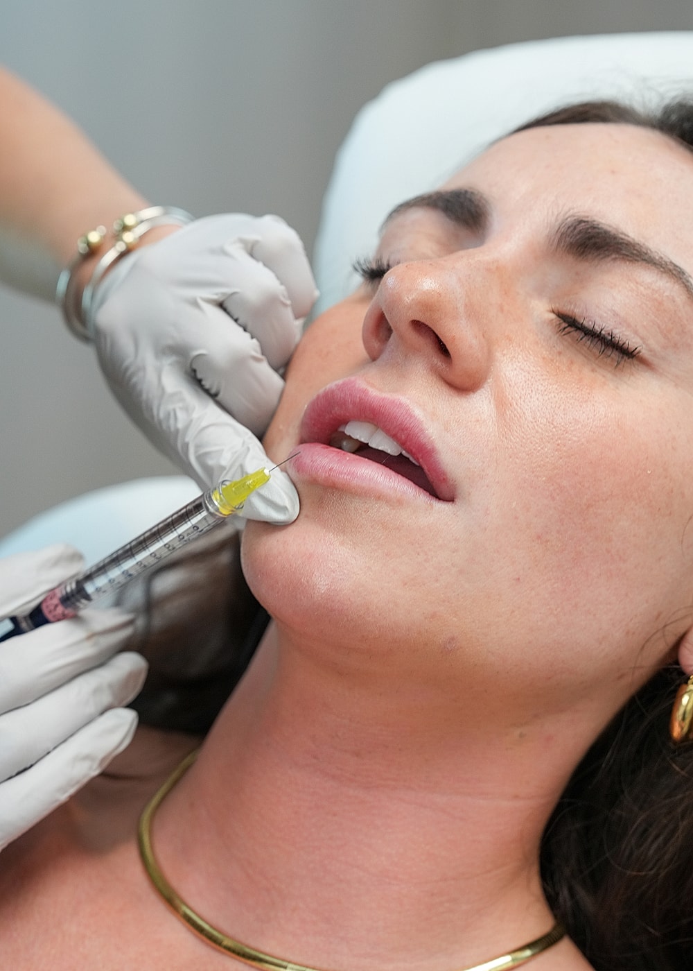 Lip injection procedure in a clinical setting