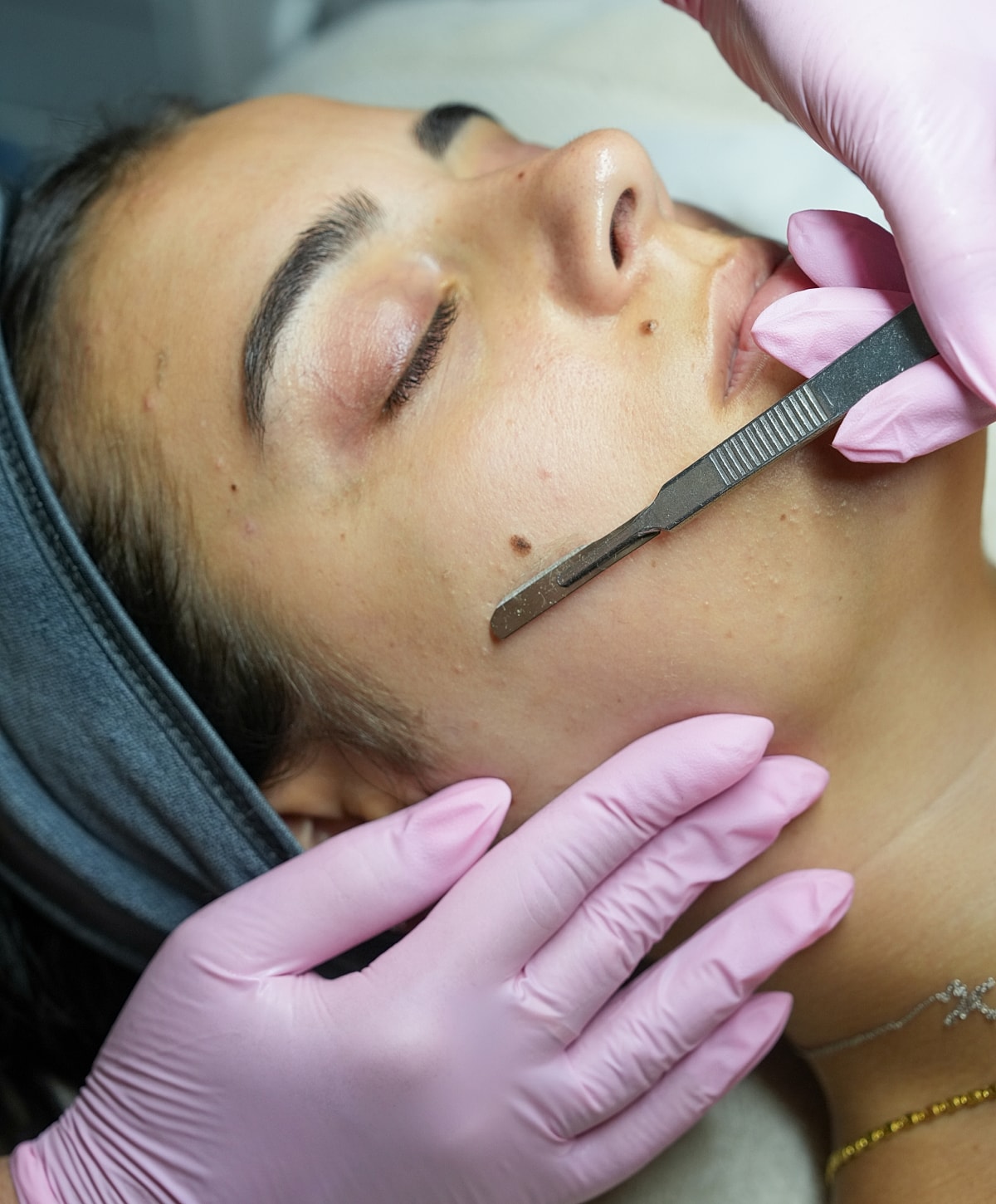 Northborough dermaplaning with LED light therapy model undergoing treatment.